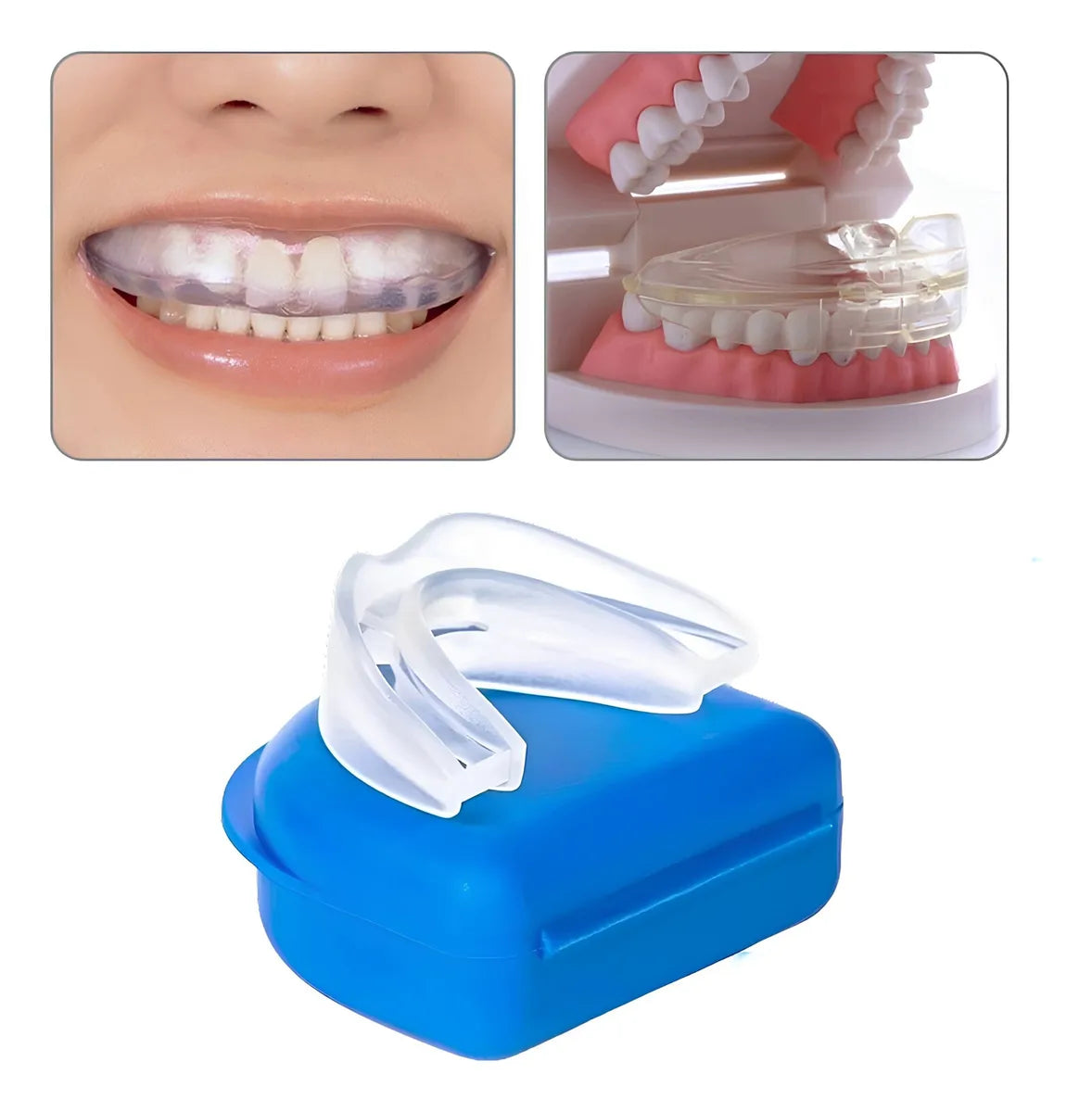 Placa Moldable Anti Bruxismo y Ronquido – RonquiFree®